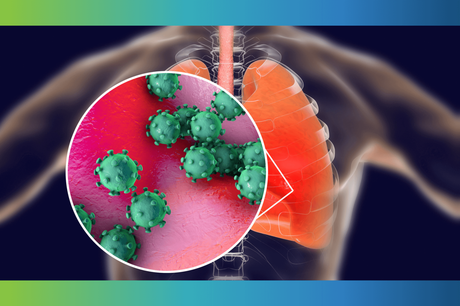 pneumonia-vaccine-who-should-get-it-and-when-pharmd-live